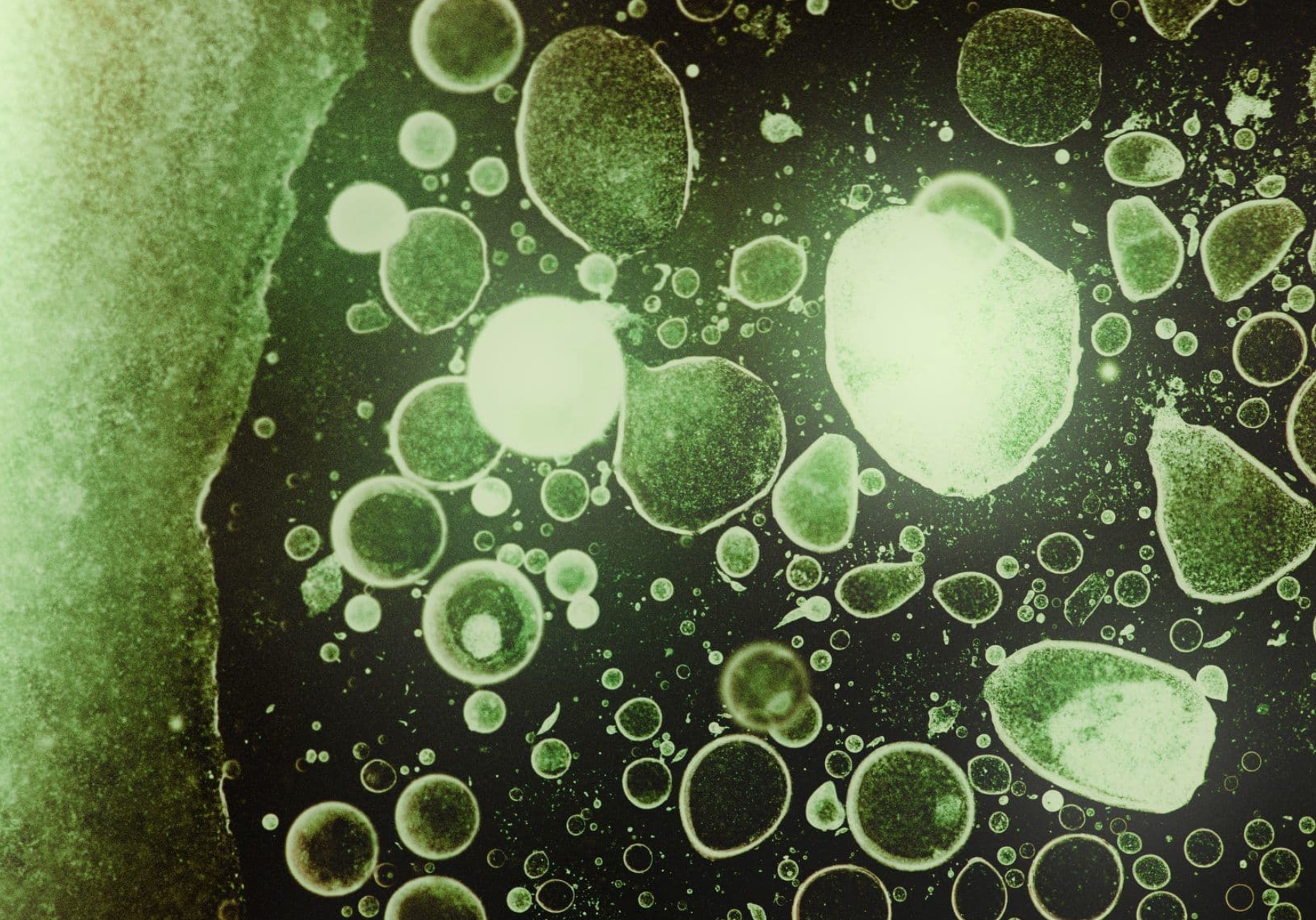 Why Particle Size Matters